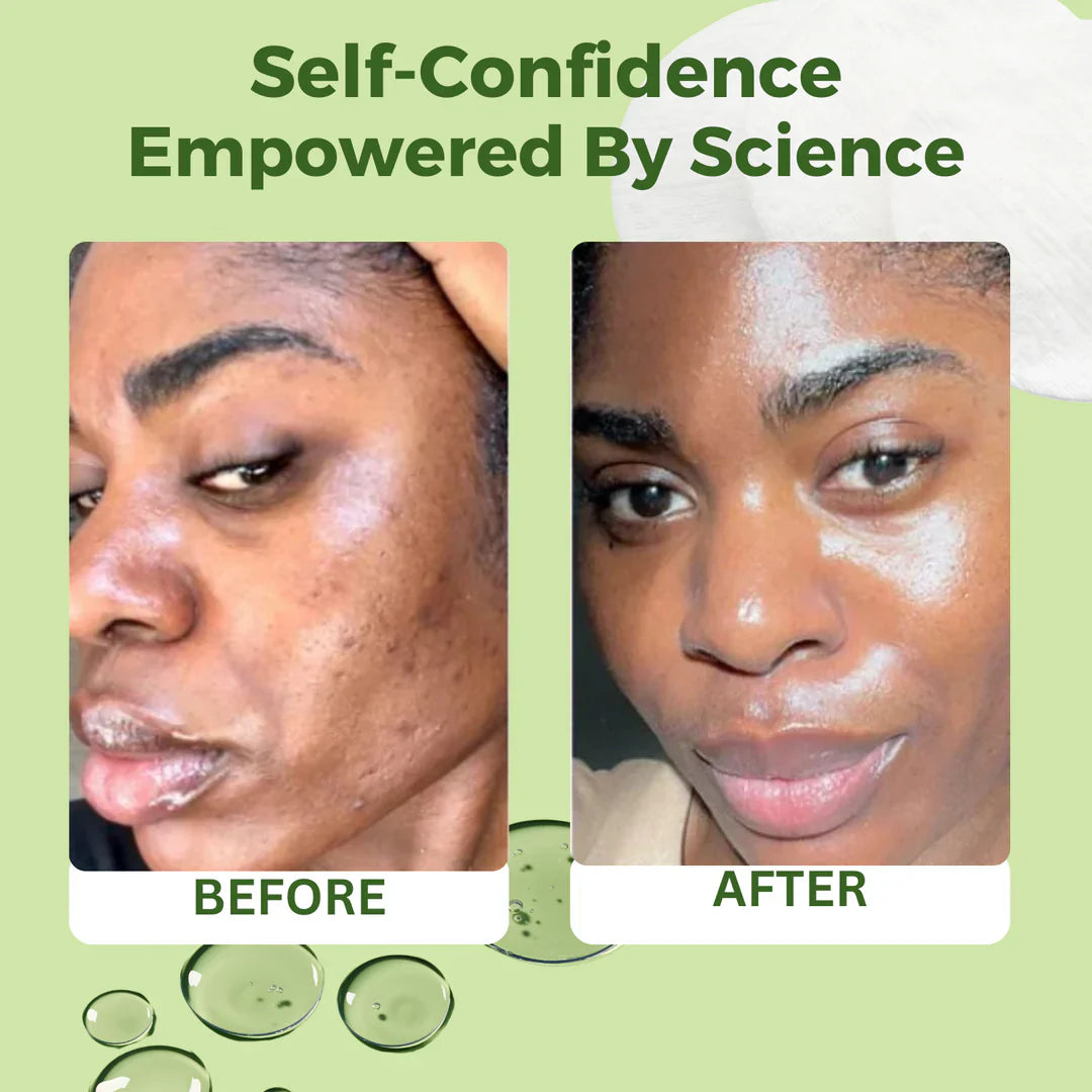 Korean Anti-Aging, Dark Spot & Wrinkle Minimizing Toner Pads