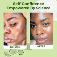 Korean Anti-Aging, Dark Spot & Wrinkle Minimizing Toner Pads